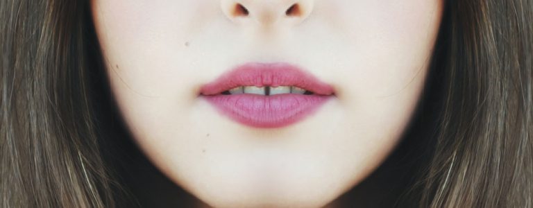Diastema